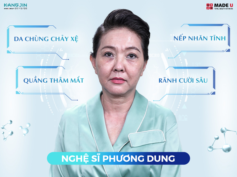 Tình trạng da nghệ sĩ Phương Dung trước khi thực hiện liệu pháp trẻ hóa 
