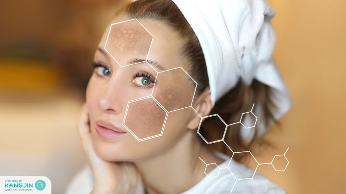 7 cách trị nám tàn nhang tại nhà từ thiên nhiên hiệu quả