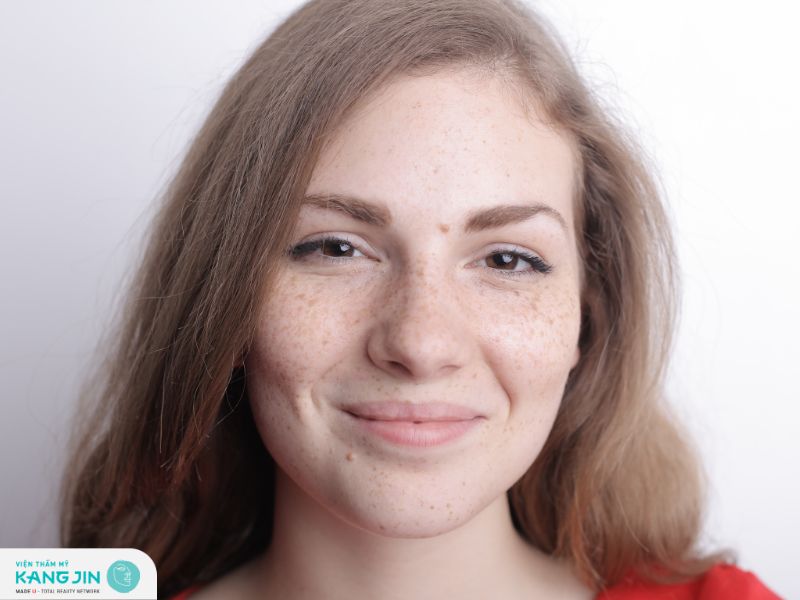 Hướng dẫn cách trị nám tàn nhang tại nhà mà bạn có thể tham khảo 