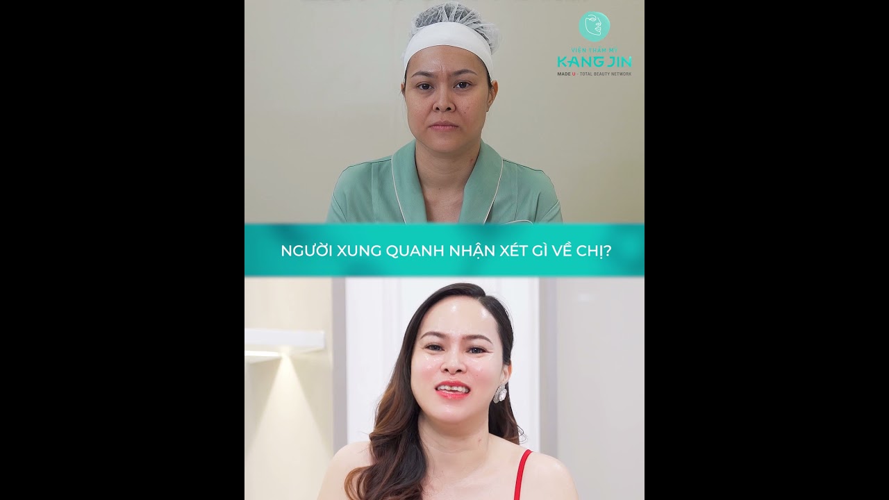 chieu-doc-tri-tieu-tam