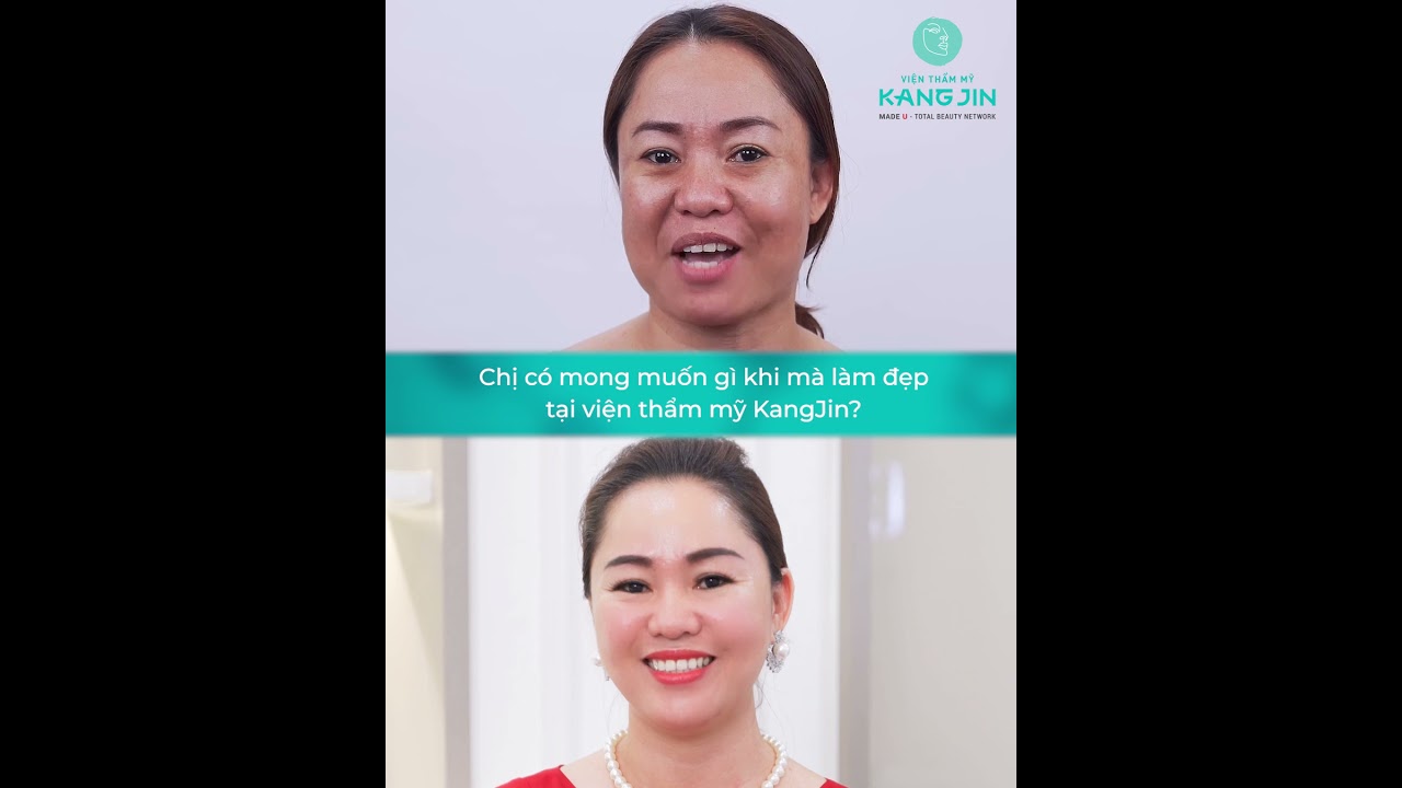 giam-doc-dia-oc-da-dep-thay-soc-sau-khi-trai-nghiem-cong-nghe-kangjin-maxcollagen-sieu-vi-diem