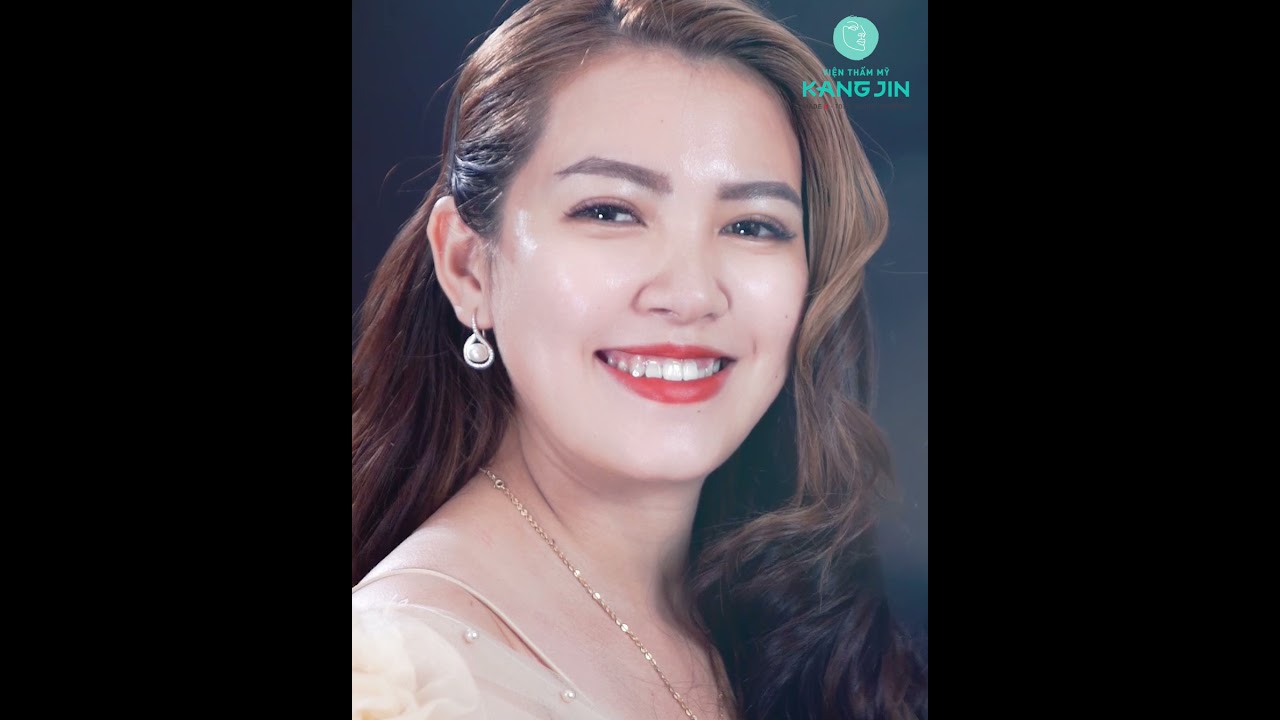 thay-the-soi-collagen-nguyen-bao-cho-cong-nghe-cang-chi-cu