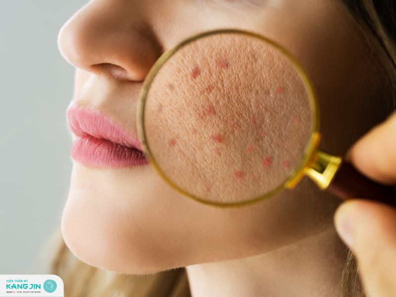 bệnh lý về da mặt