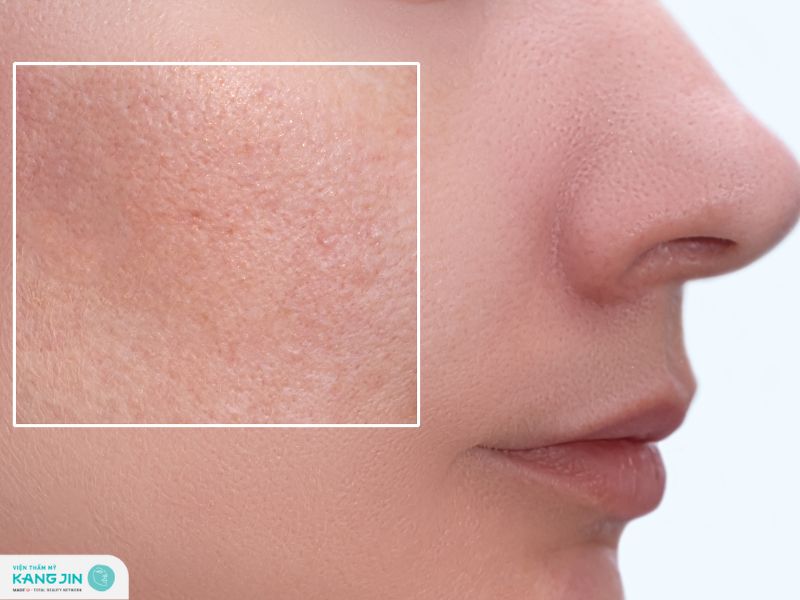 bệnh lý về da mặt