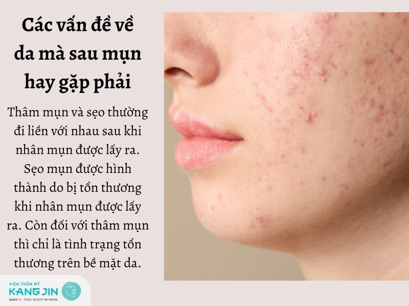 Xuất hiện các vết thâm vào sẹo trên khuôn mặt