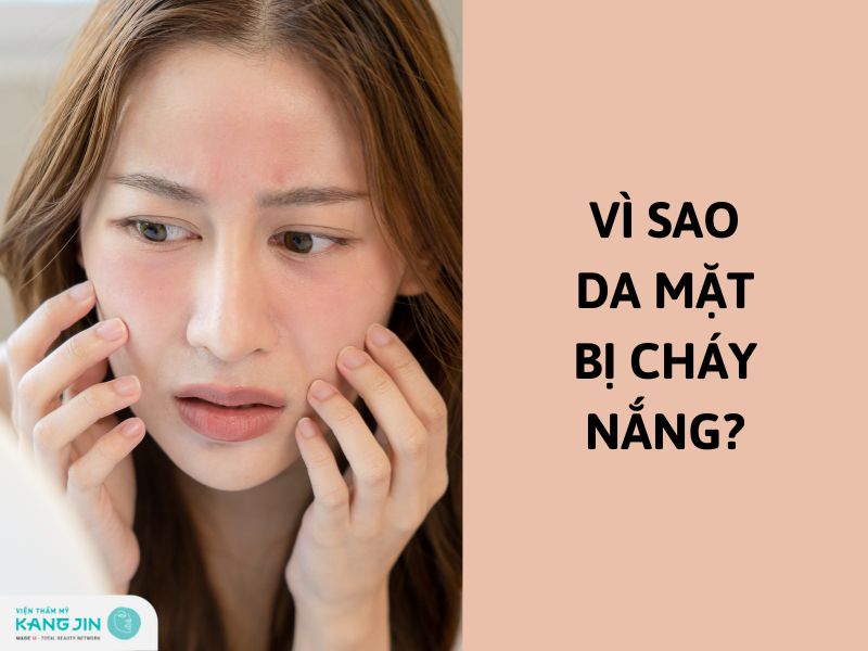 da mặt cháy nắng