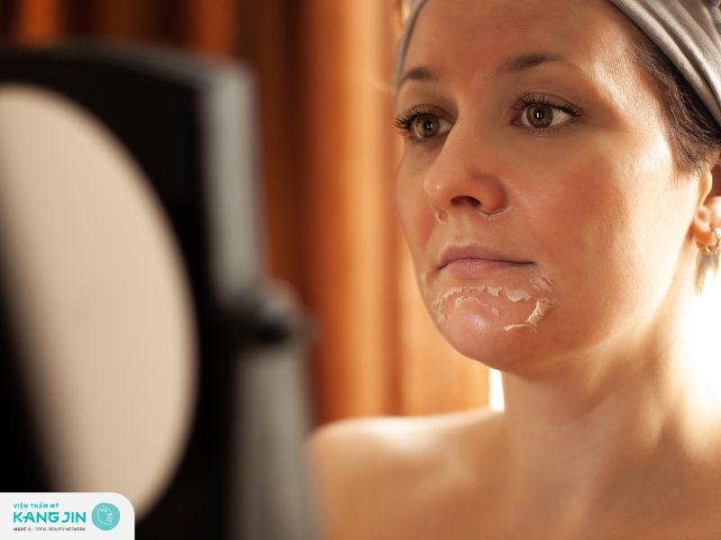 Hướng dẫn cách điều trị nấm da mặt tại nhà