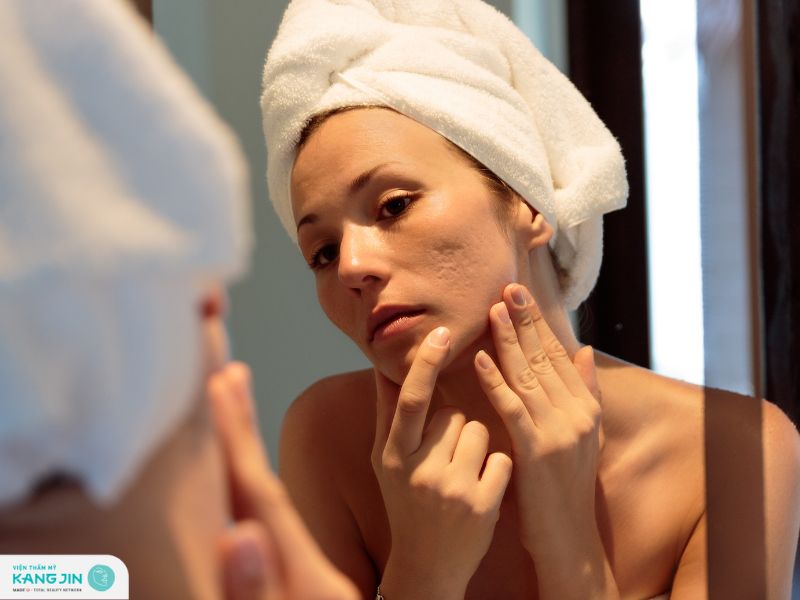 phục hồi da mặt bị rỗ