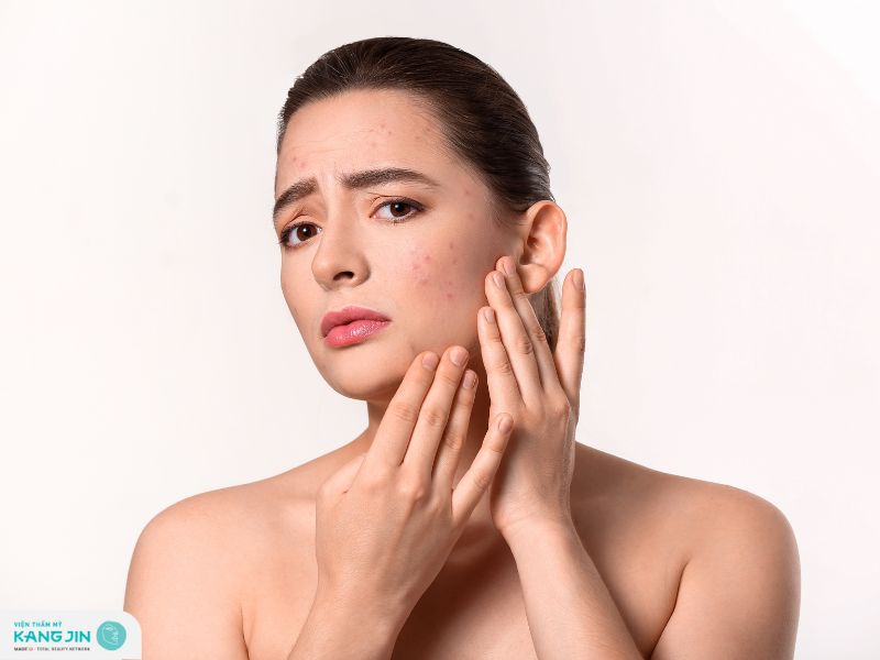 phục hồi da sau dị ứng mỹ phẩm