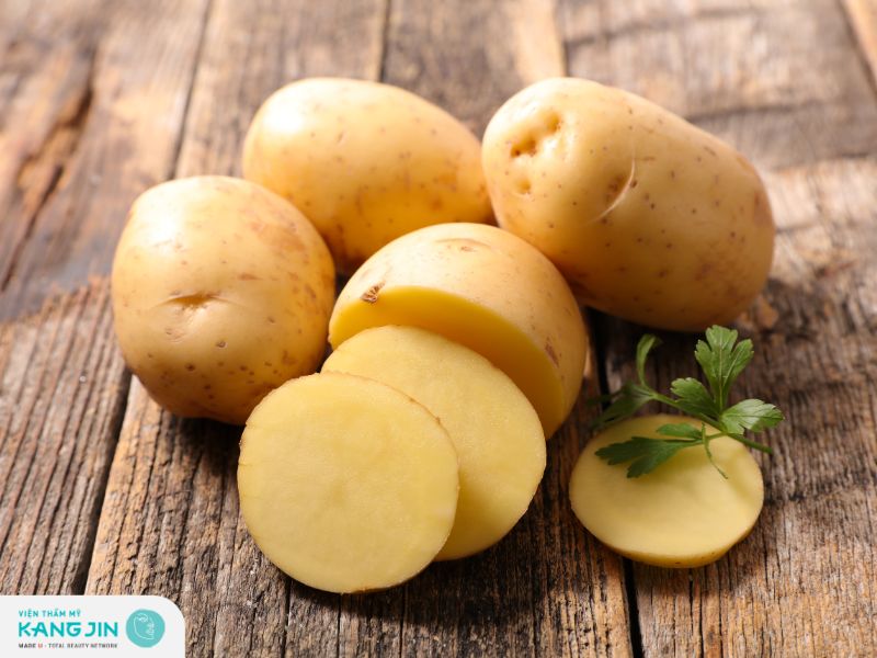 Trị nám sau sinh bằng khoai tây hiệu quả tại nhà 