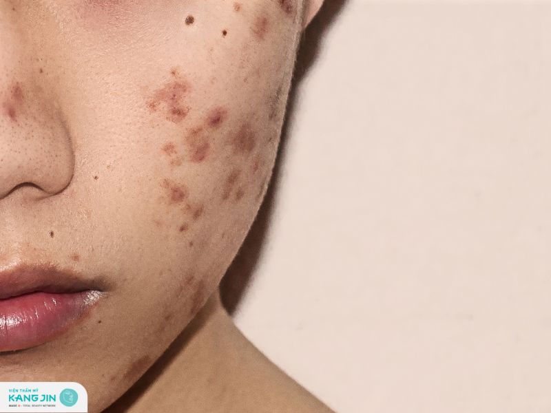 da không đều màu phải làm sao