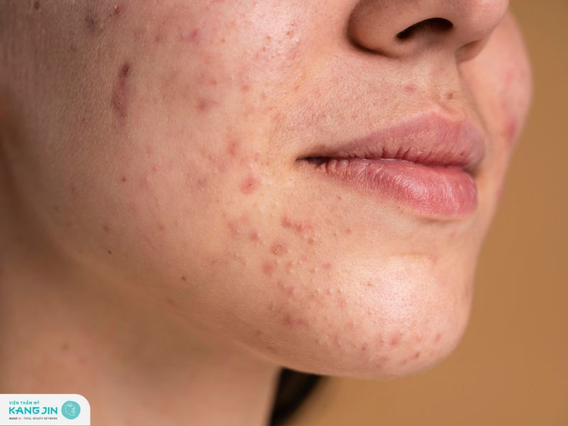 da mặt bị nhiễm chì