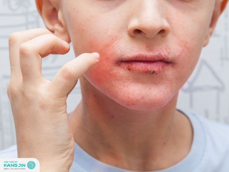 da mặt dị ứng