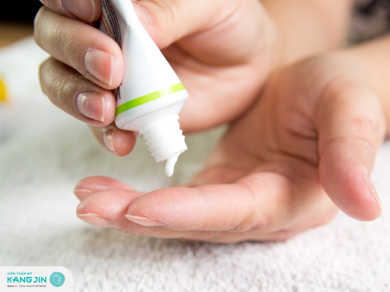 Bôi thuốc kháng sinh khi bị chàm da mặt nặng 