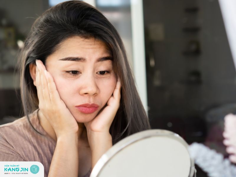 Cách trị thâm quầng mắt bẩm sinh