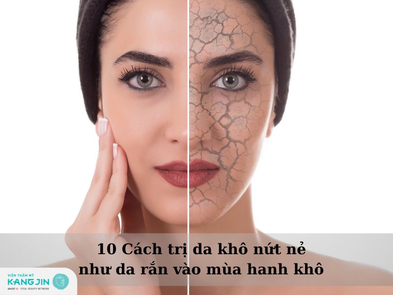 cách điều trị khô da nứt nẻ 