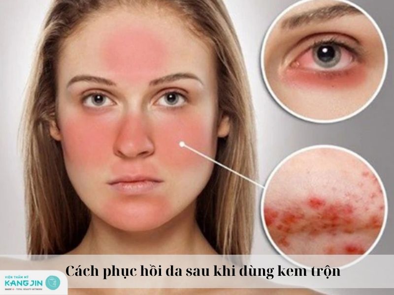 Sau khi dùng kem trộn làm thế nào để phục hồi da