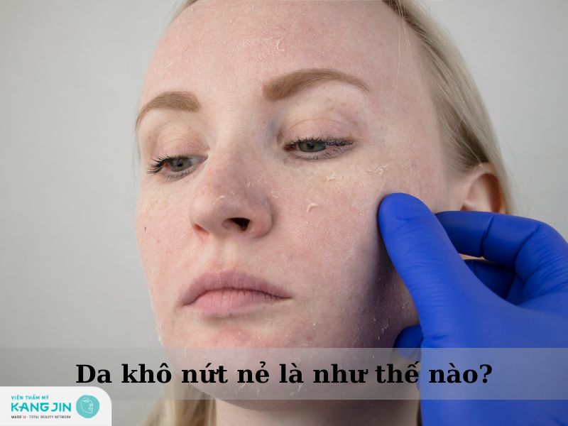 da khô bị nứt nẻ là như thế nào? 