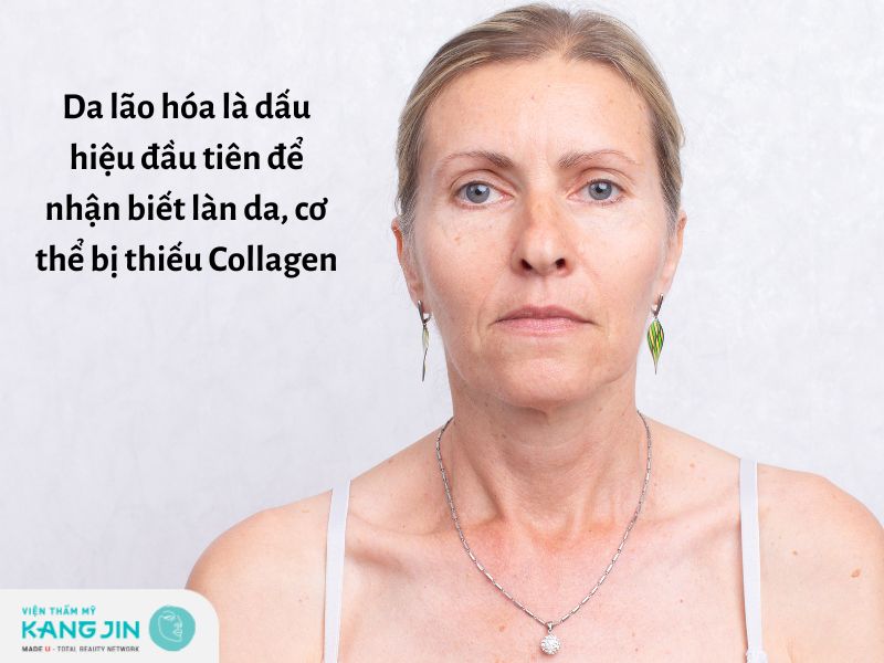 Dấu hiệu thiếu Collagen
