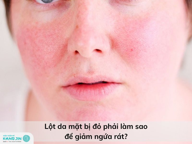 sau khi lột da mặt xong bị đỏ phải làm sao