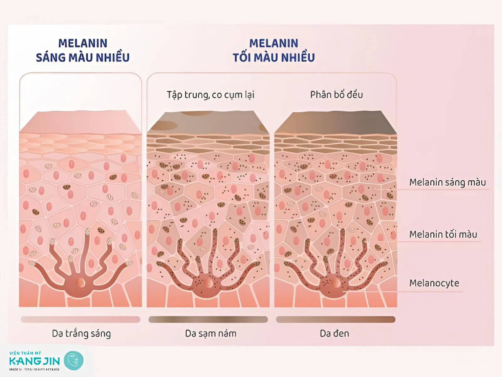 Rối loạn sắc tố melanin: Khái niệm, nguyên nhân và cách khắc phục