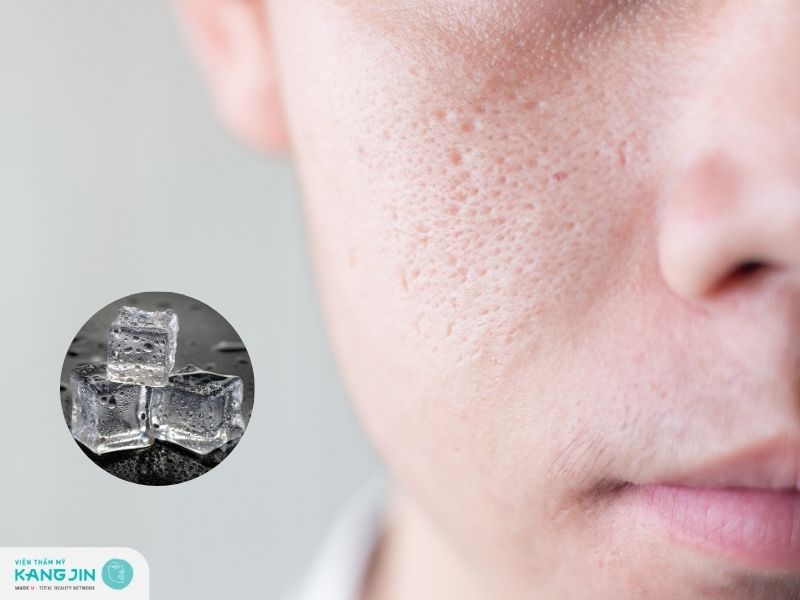 Hướng dẫn cách se khít lỗ chân lông bằng đá lạnh