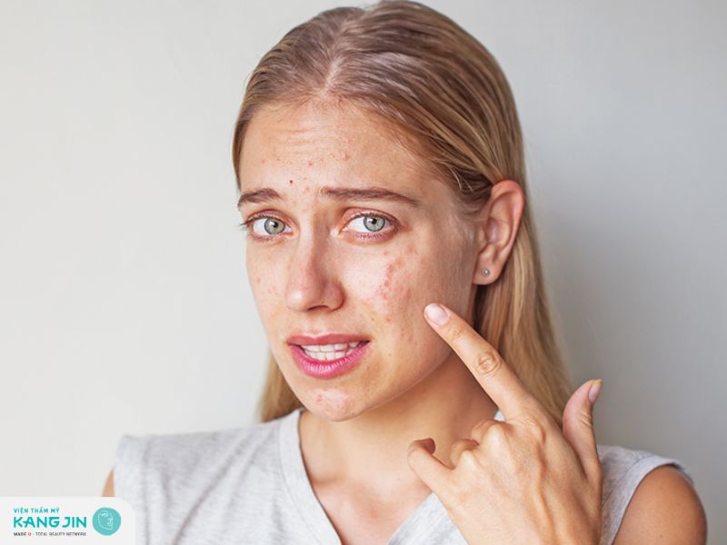 6 Cách thải độc da nhiễm corticoid và bí quyết chăm sóc