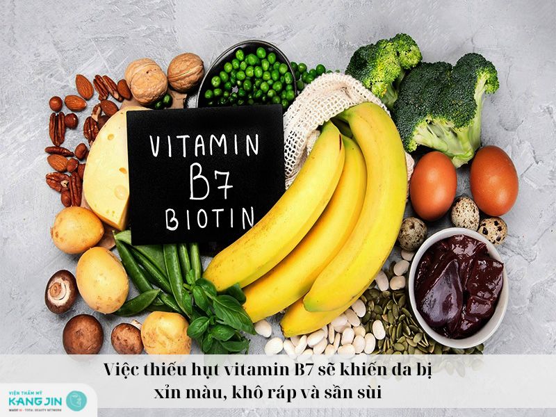 thiếu vitamin B7 khiến da bị khô