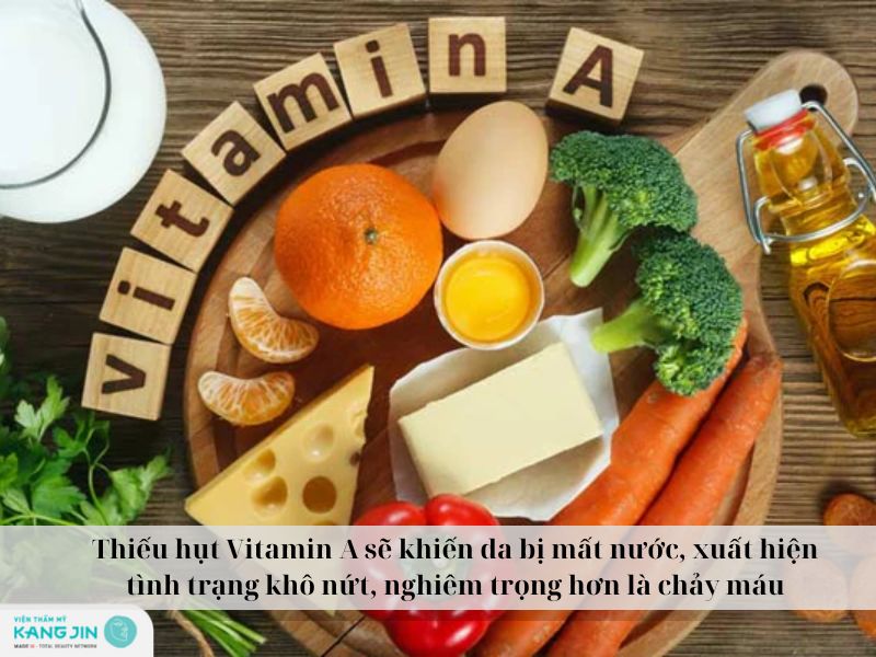 da khô là biểu hiện của thiếu vitamin A