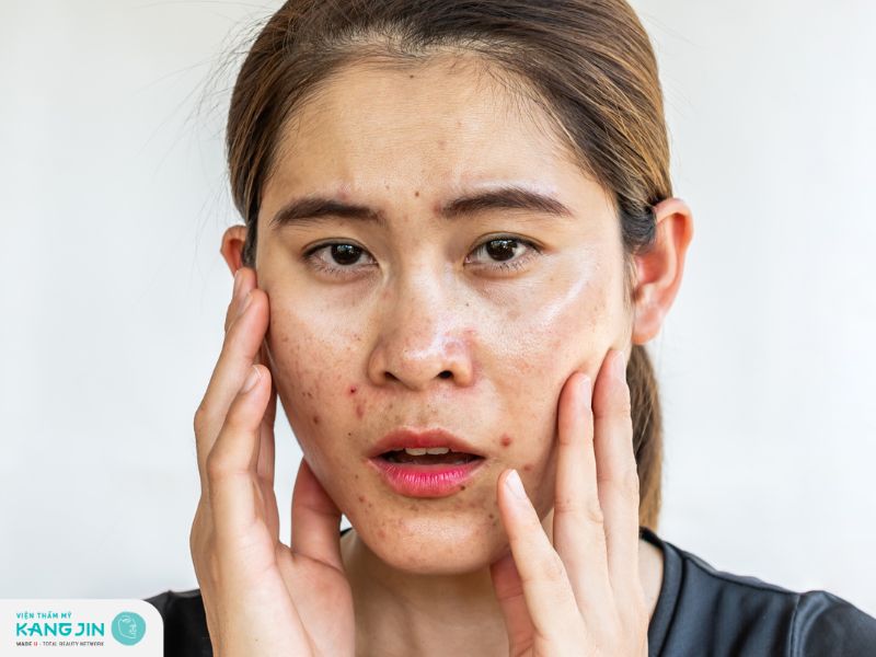 Cách phân biệt da hỗn hợp thiên dầu và thiên khô