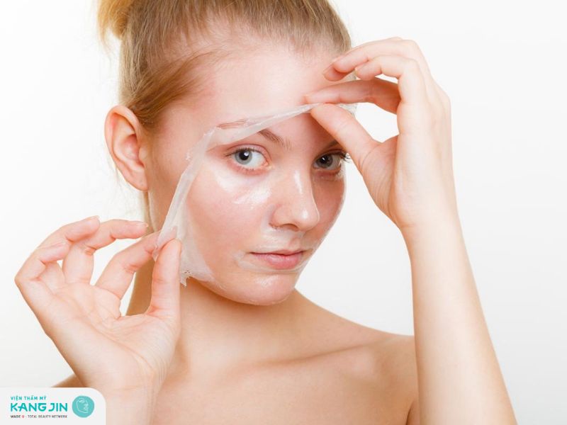 Có nên thực hiện lột da mặt không? Tại sao