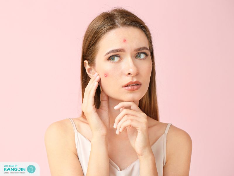 da mặt dị ứng nổi mẩn đỏ