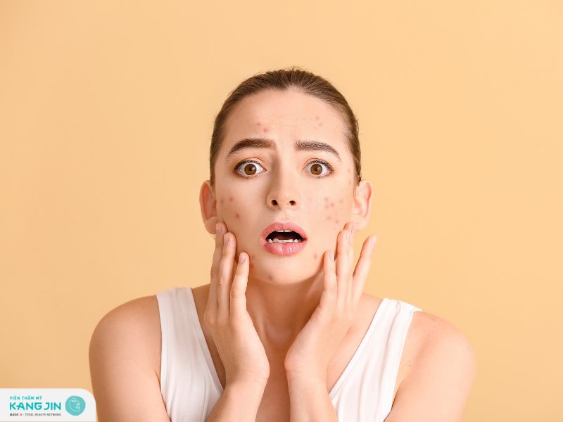 da mặt dị ứng nổi mẩn đỏ