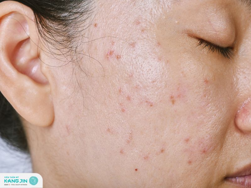 thắc mặc khi bị dị ứng 