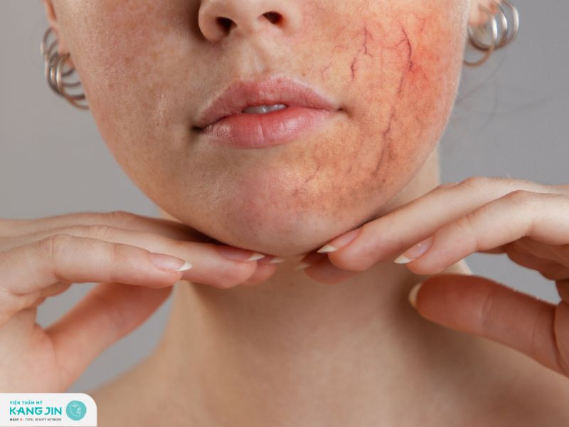 sưng mặt vì thuốc bắc tái tạo da