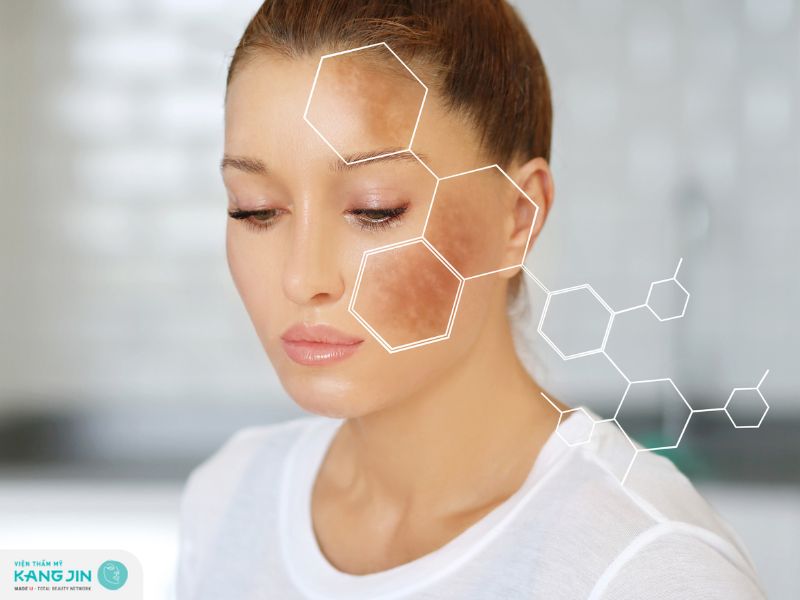 cách làm giảm sắc tố melanin