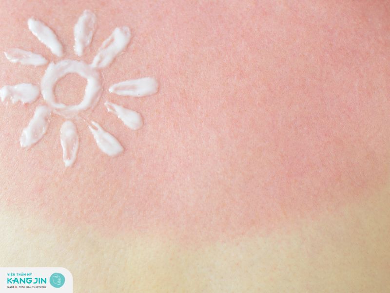 phục hồi được nếu được chăm sóc đúng cách