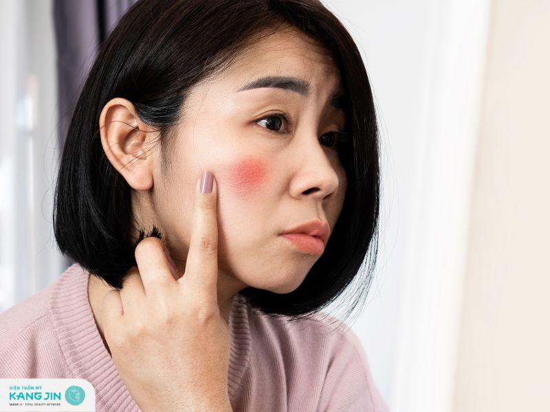 phục hồi da sau lăn kim