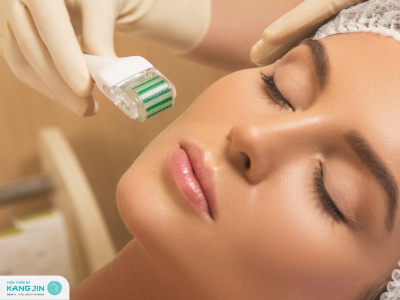 phục hồi da sau lăn kim