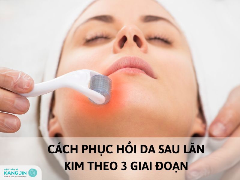 phục hồi da sau lăn kim