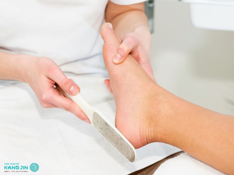 Cách tẩy da chết gót chân hiệu quả tại nhà