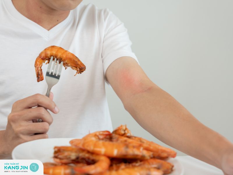 Tránh ăn các loại thực phẩm có thể gây dị ứng sau khi thực hiện tái tạo da 