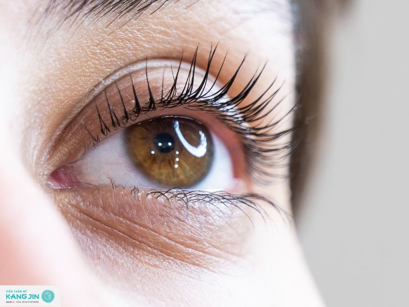 vùng da dưới mắt bị chảy xệ