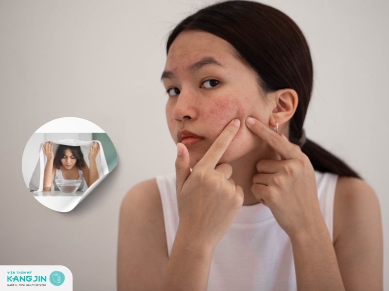 Giải đáp xông mặt xong có nên nặn mụn không?