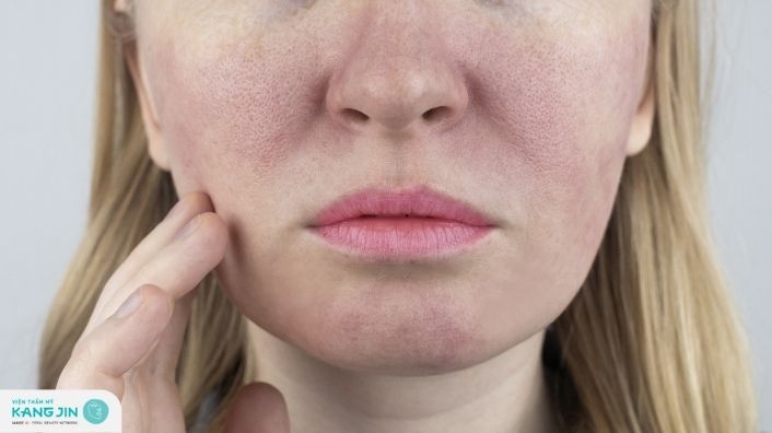 Nguyên nhân và cách khắc phục da sạm đen lỗ chân lông to