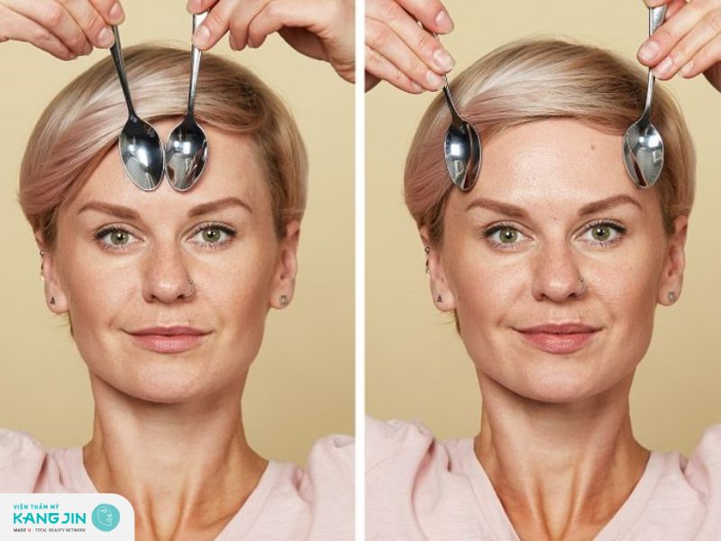 Giảm nếp nhăn vùng lông mày và trán bằng cách massage thìa lạnh