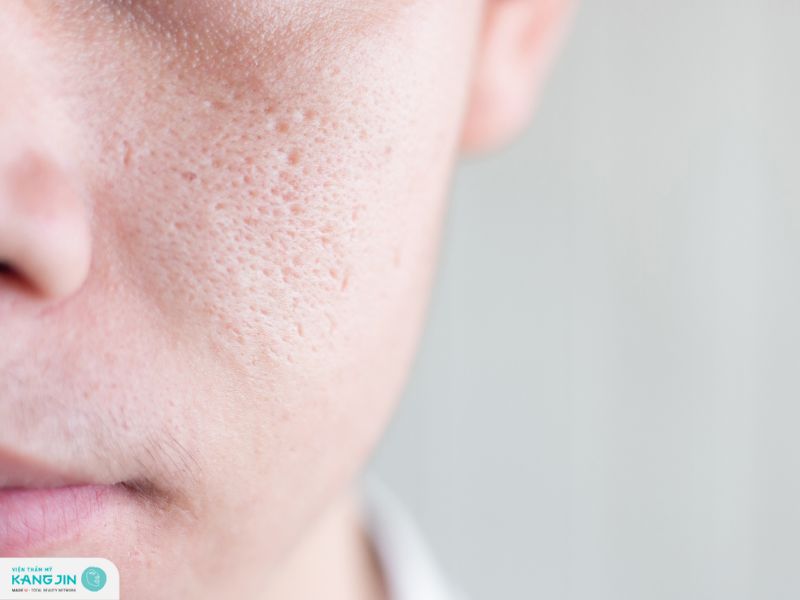 se khít lỗ chân lông cho nam