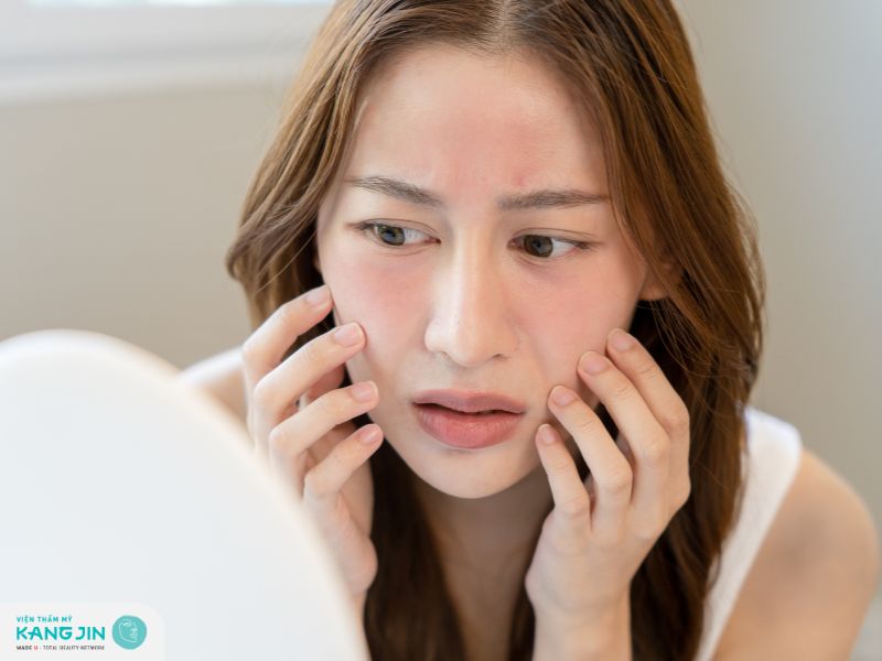 Da nhạy cảm cần chọn loại mặt nạ có thành phần dịu nhẹ