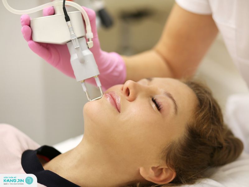 trị nám bằng laser