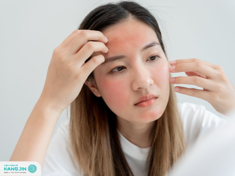 dầu dừa có trị mụn được không